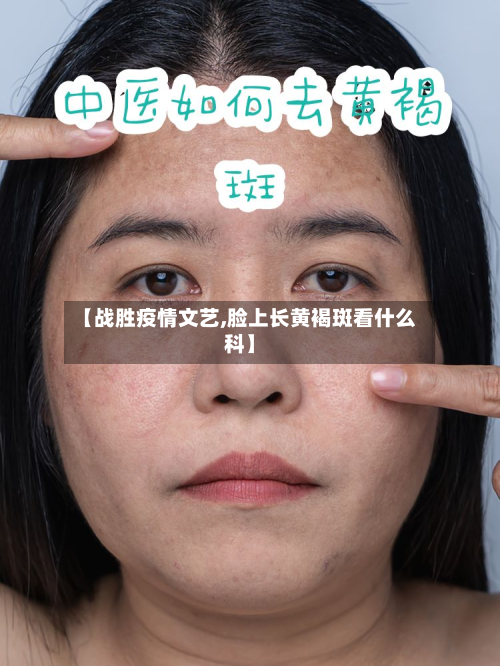 【战胜疫情文艺,脸上长黄褐斑看什么科】-第2张图片